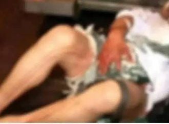 EN LOURDES COLÓN UNA MUJER LE CORTO EL PENE A SU PAREJA POR CELOS.