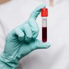 JAPÓN INICIA PRUEBAS DE SANGRE ARTIFICIAL UNIVERSAL EN HUMANOS