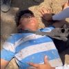 MOTOCICLISTA RESULTA LESIONADO EN REDONDEL SANTA MARÍA, SANTA ANA