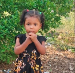 NIÑA DE 2 AÑOS PERMANECE EN ESTADO CRÍTICO TRAS SUFRIR MORDEDURA DE SERPIENTE EN HONDURAS